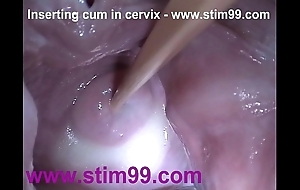Flier cream cum back cervix thither dilatation wet crack send back